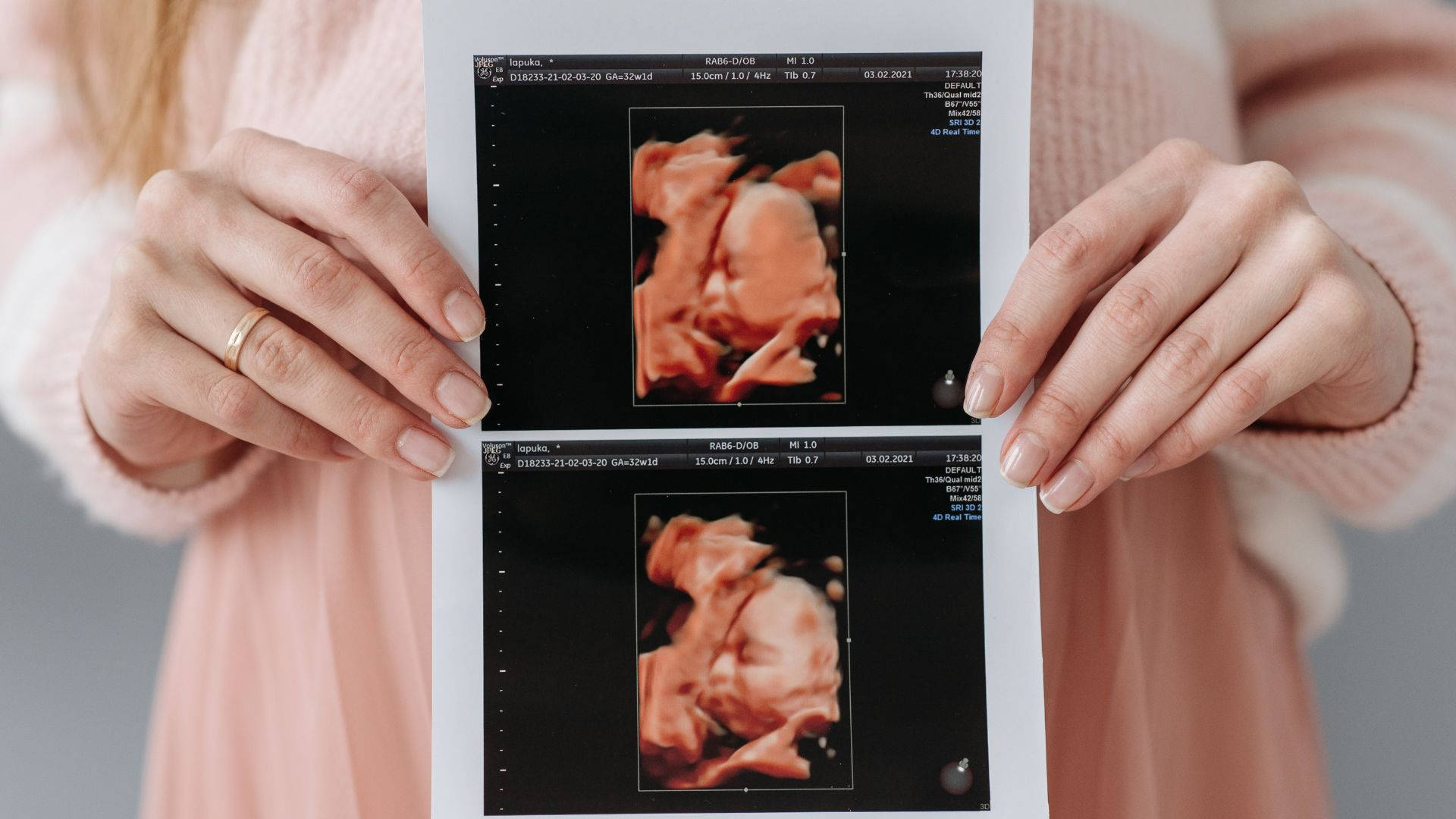 pink sweater, ultrasound images, 3D views, Full HD Desktop Wallpaper
