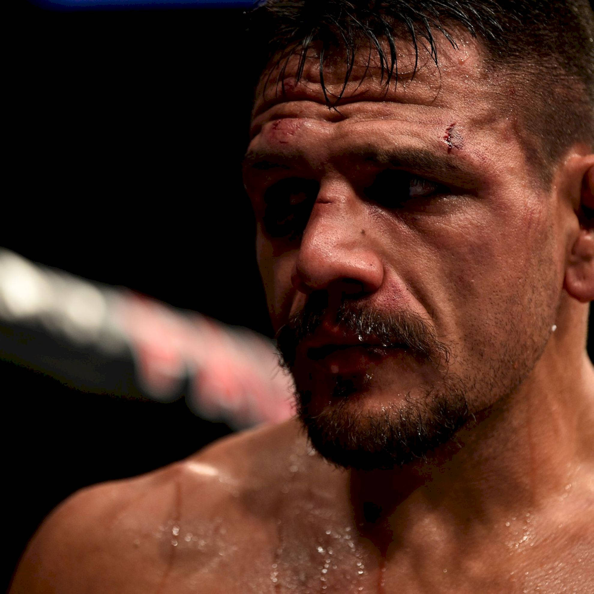 Rafael Dos Anjos, cuts on face, bruised fighter, Full HD Desktop Wallpaper