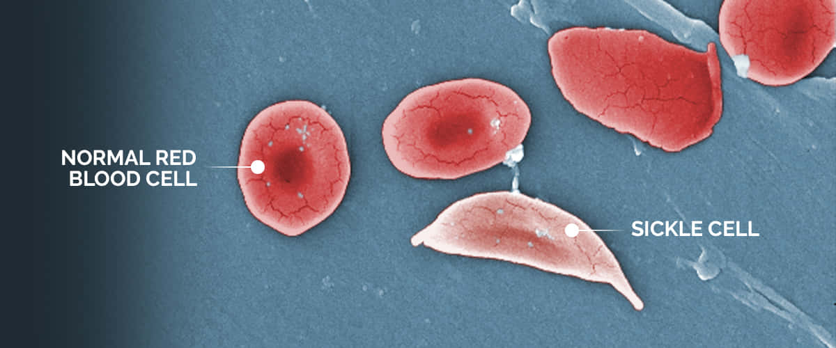 red blood cells, sickle-shaped cell, blue textured background, SD Desktop Wallpaper