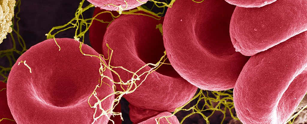 red blood cells, fibrin strands, microscope, SD Desktop Wallpaper