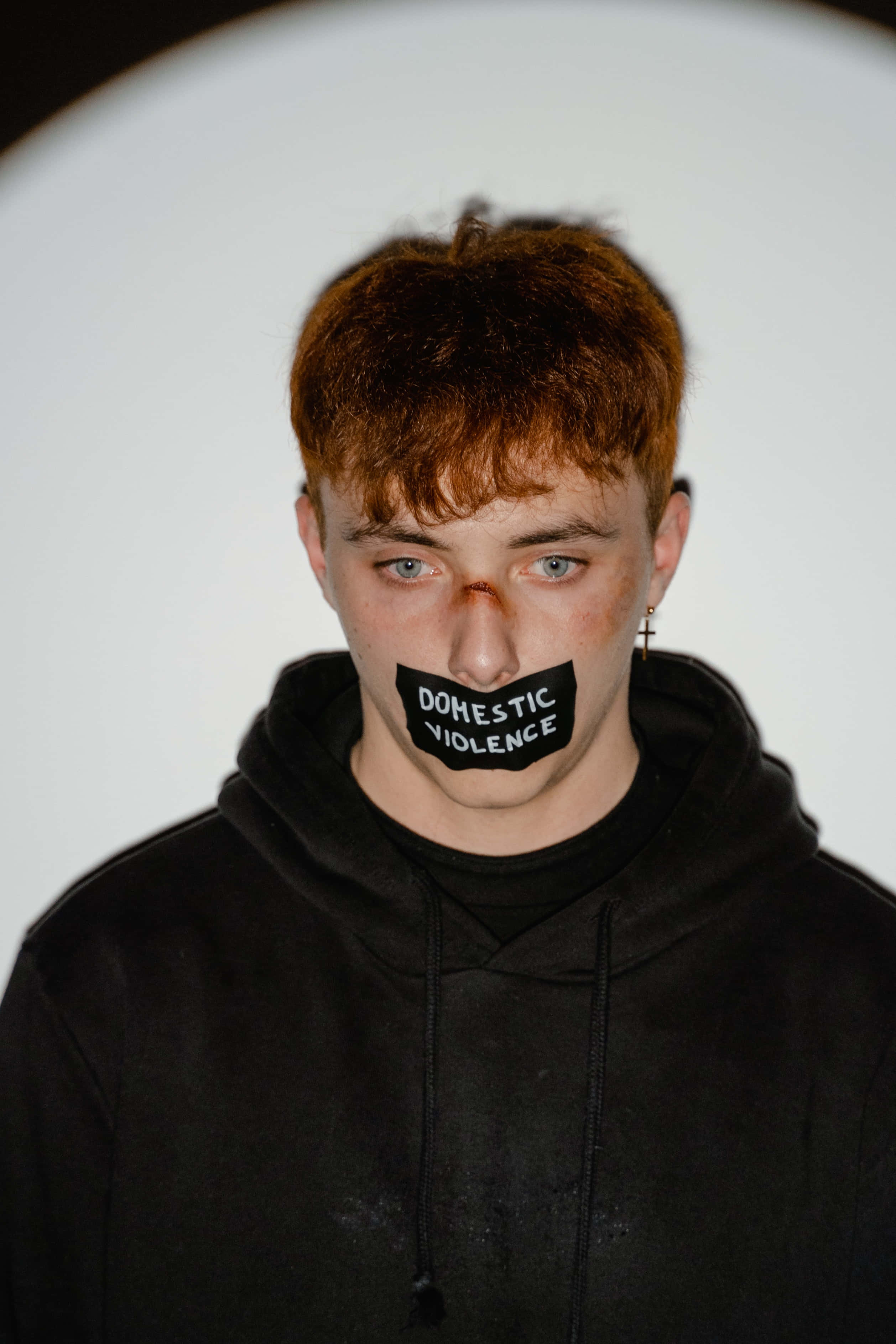 bruised boy, red hair, blue eyes, 2K Phone Wallpaper