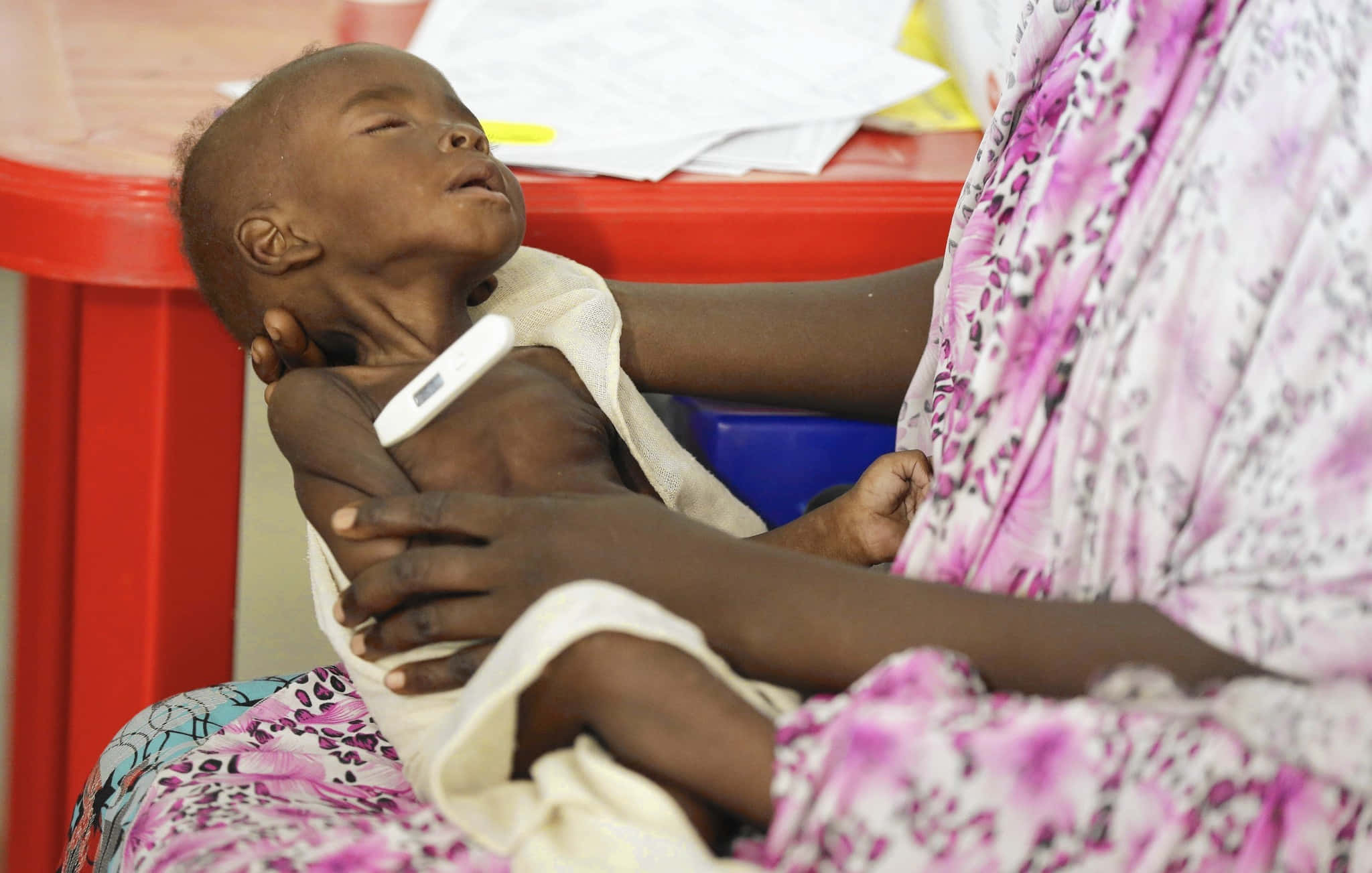 emaciated sleeping child, malnourished infant, thermometer, Full HD Desktop Wallpaper