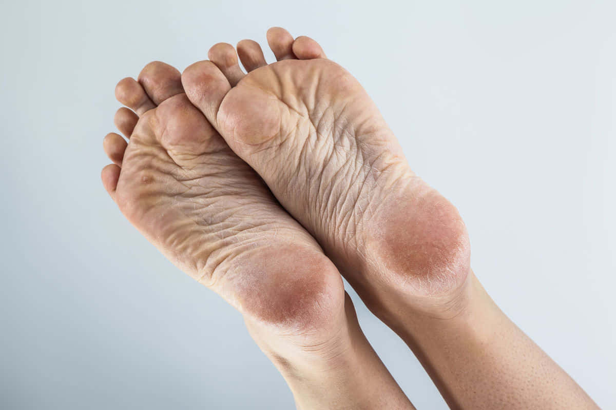 wrinkly foot sole, reddened soles, soft gray background, SD Desktop Wallpaper