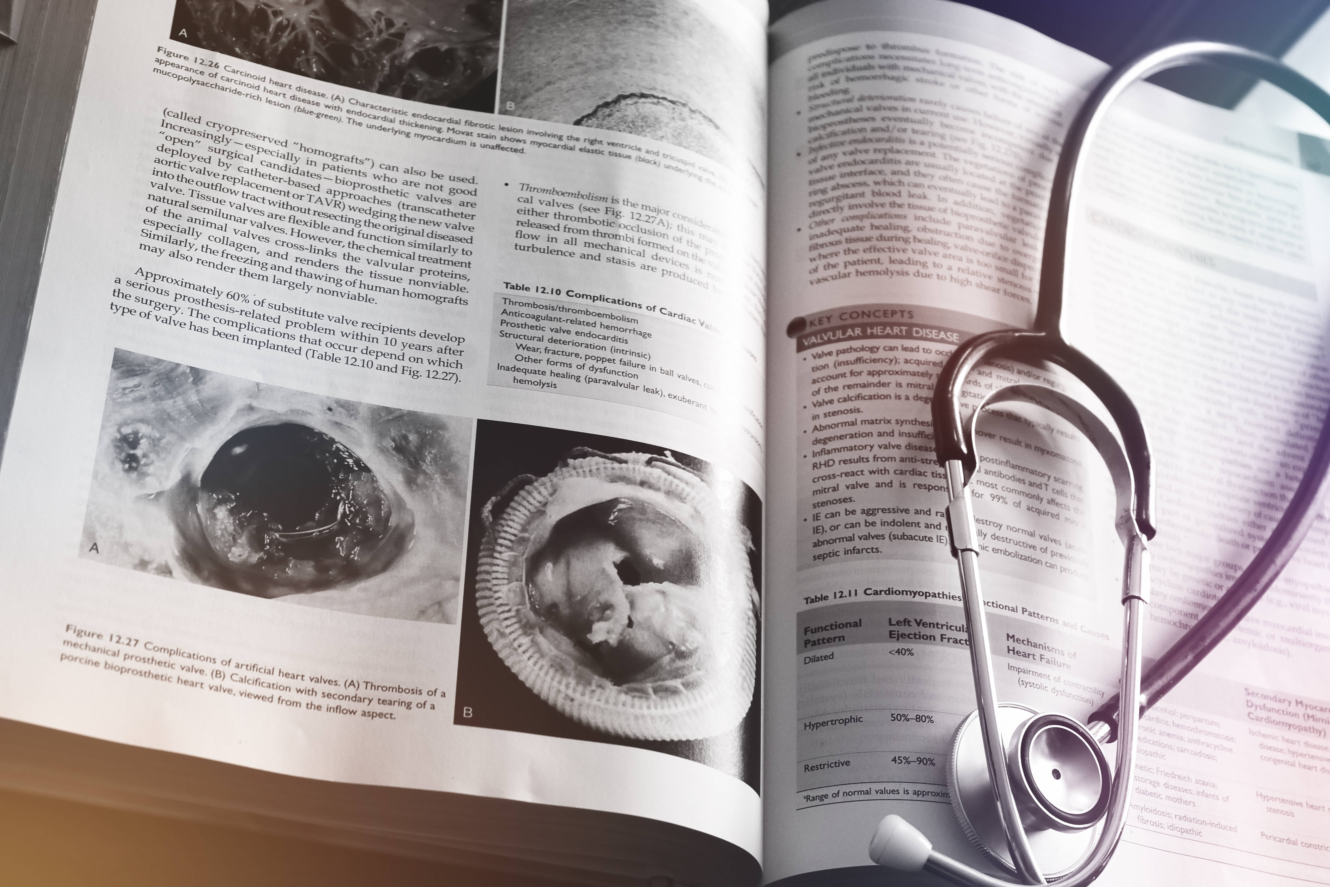 stethoscope, medical book, cardiac diagrams, 4K Desktop Wallpaper