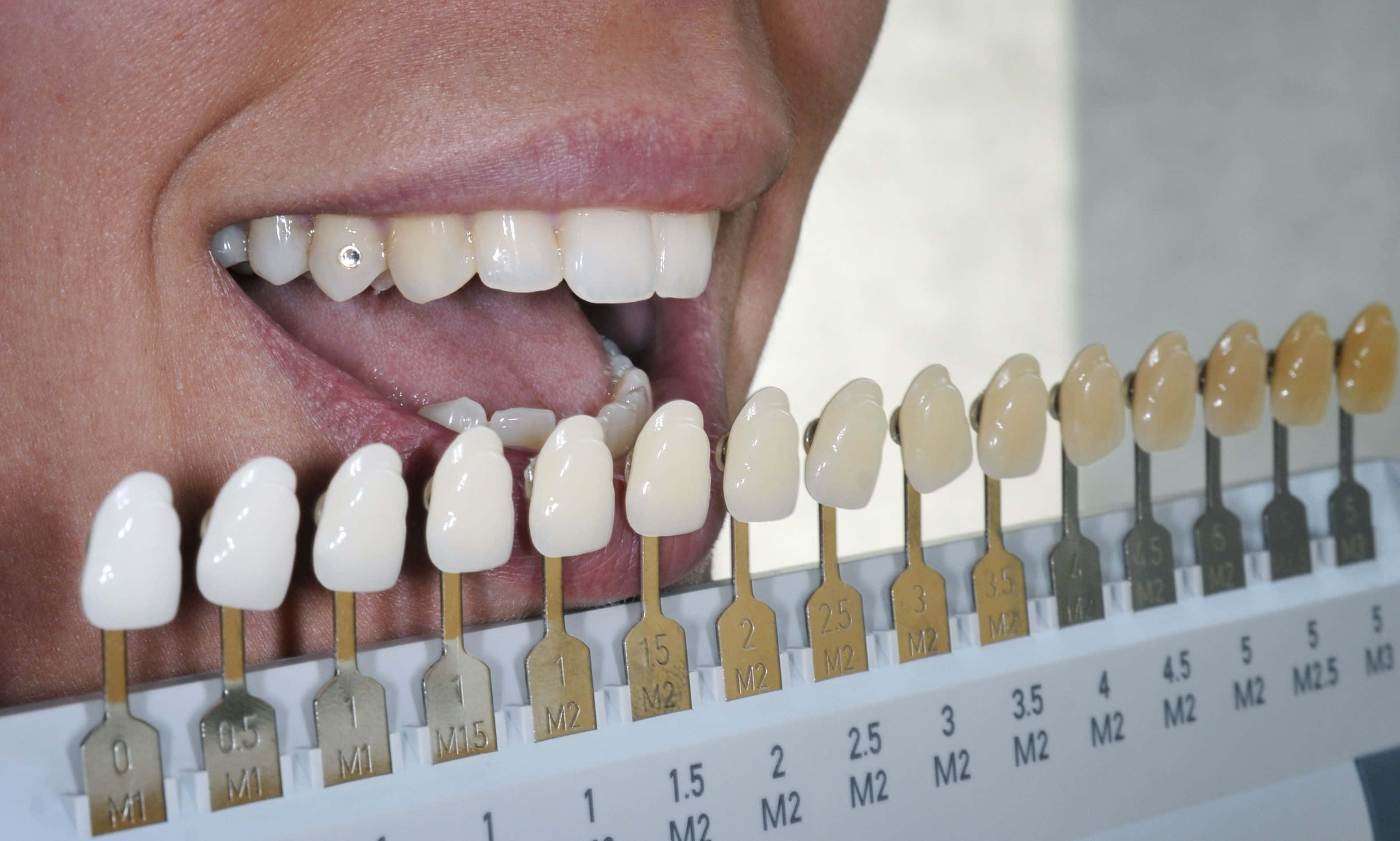 teeth whitening, dental shade guide, close-up, 2K Desktop Wallpaper
