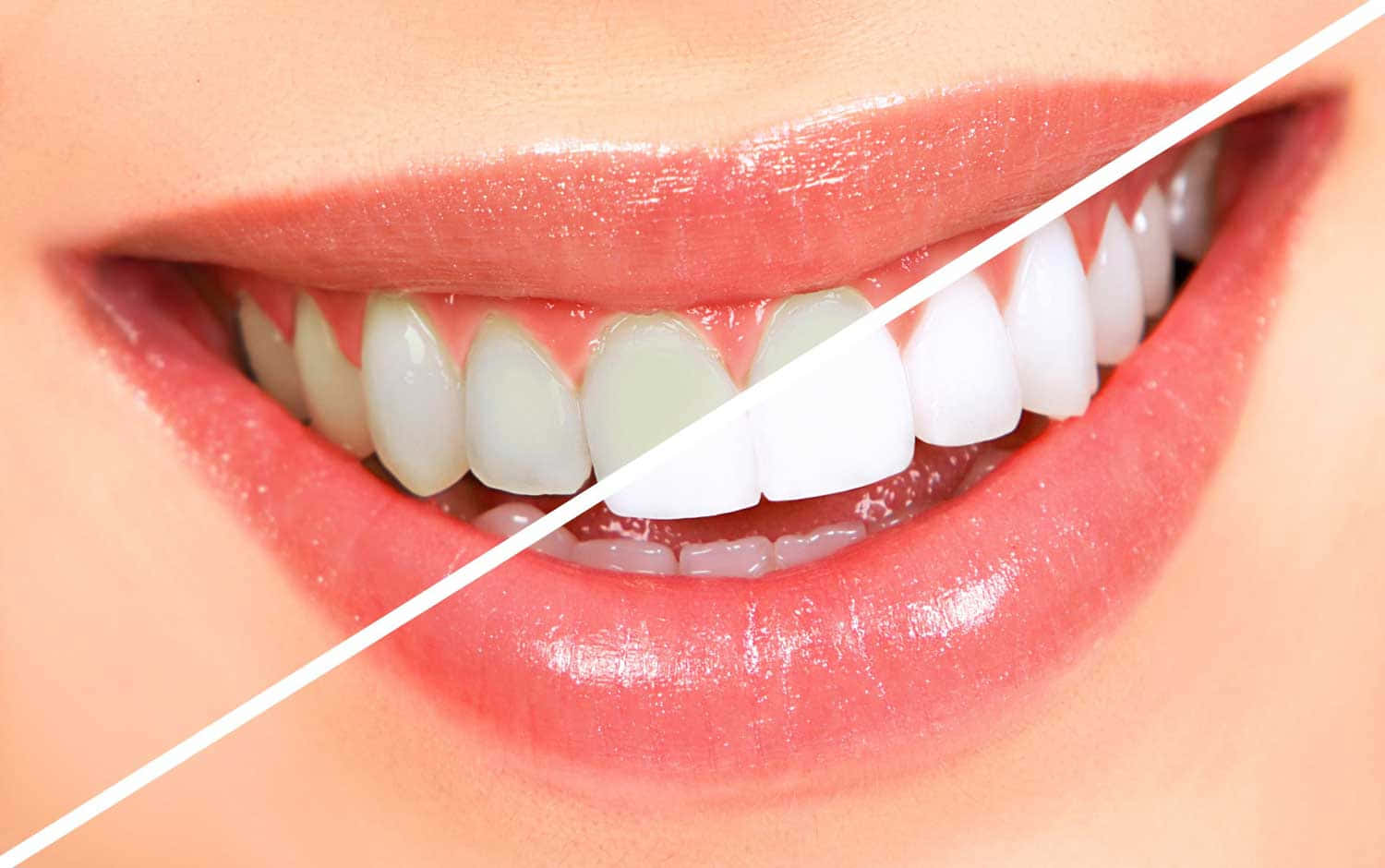 teeth whitening, smiling mouth, natural teeth, HD Desktop Wallpaper