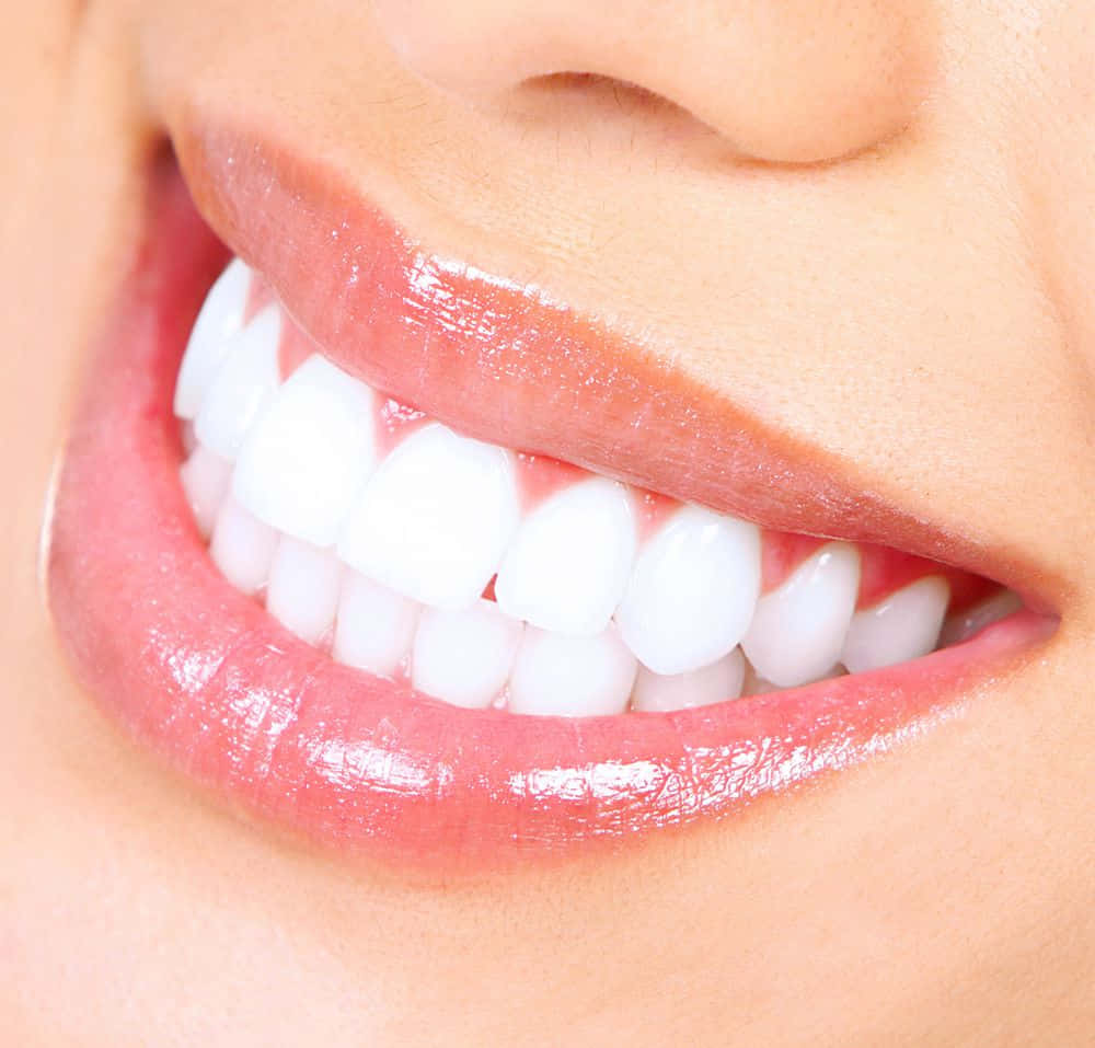 teeth whitening, bright smile, perfectly white teeth, SD Desktop Wallpaper