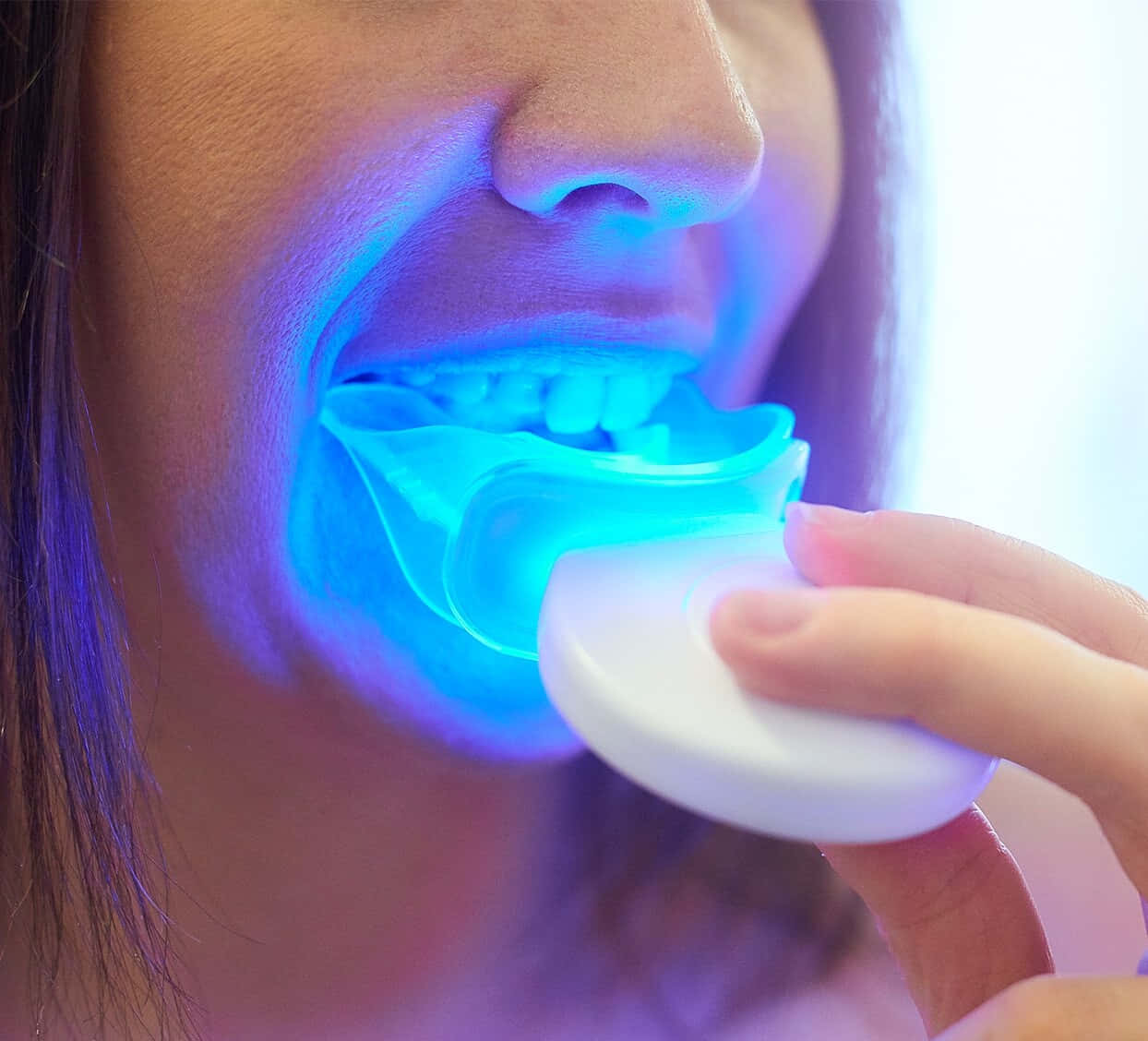 blue LED light, custom mouth tray, close-up, SD Desktop Wallpaper