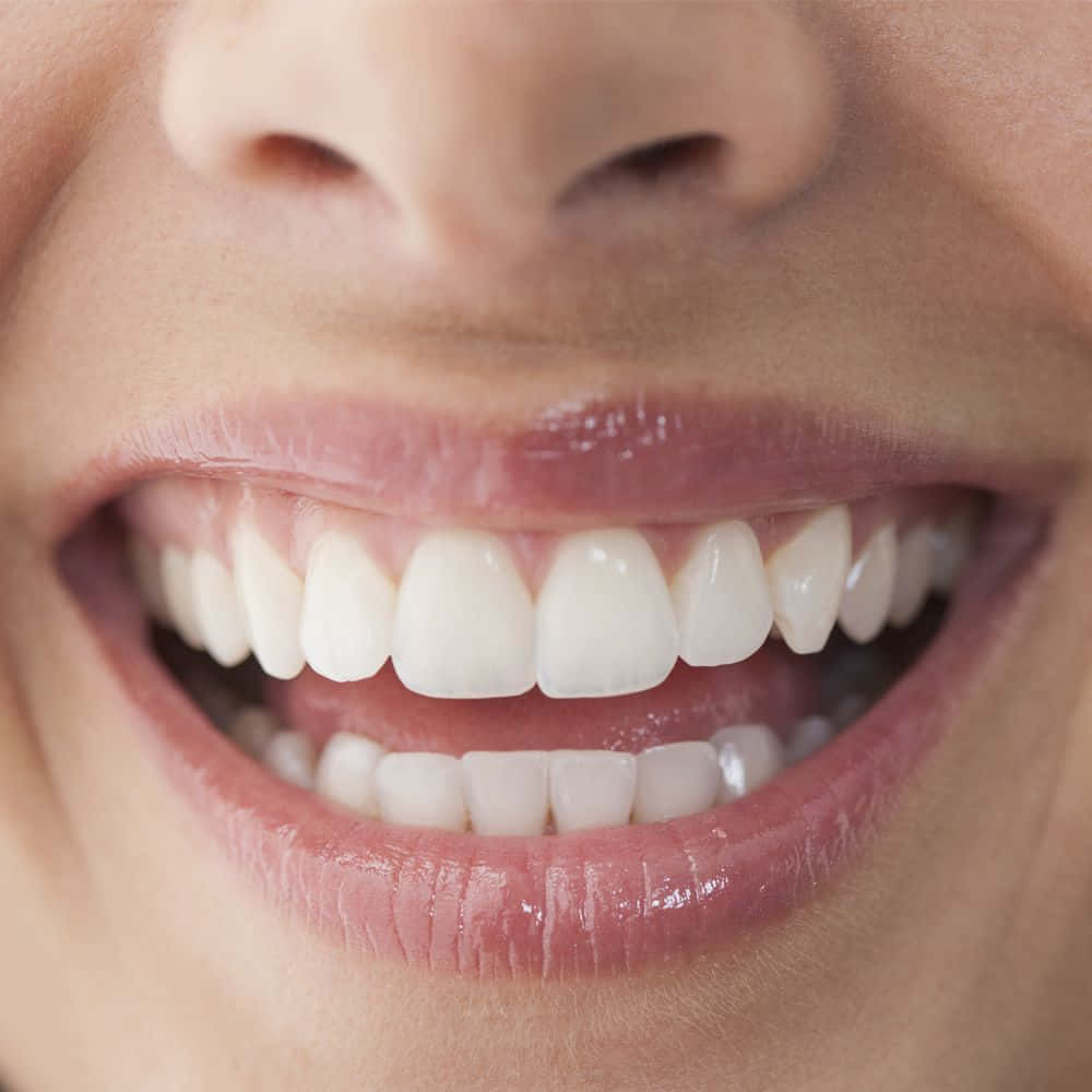 teeth whitening, bright white smile, glossy lips, SD Desktop Wallpaper
