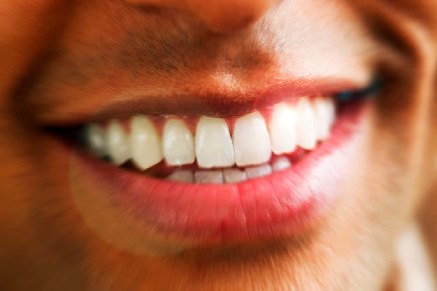 teeth whitening, bright white smile, close-up photo, HD Desktop Wallpaper