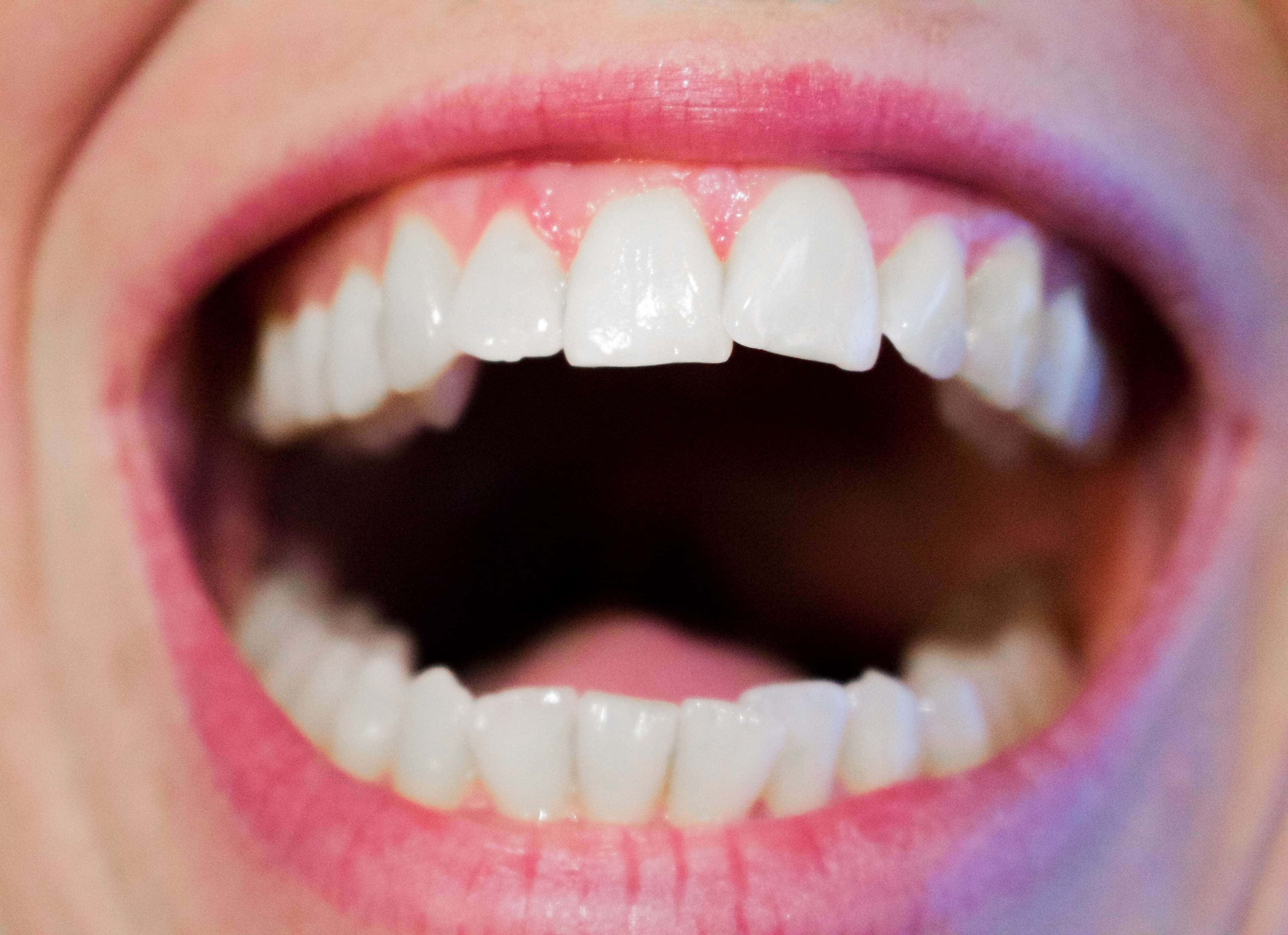 open mouth, bright white teeth, pink lips, 4K Desktop Wallpaper