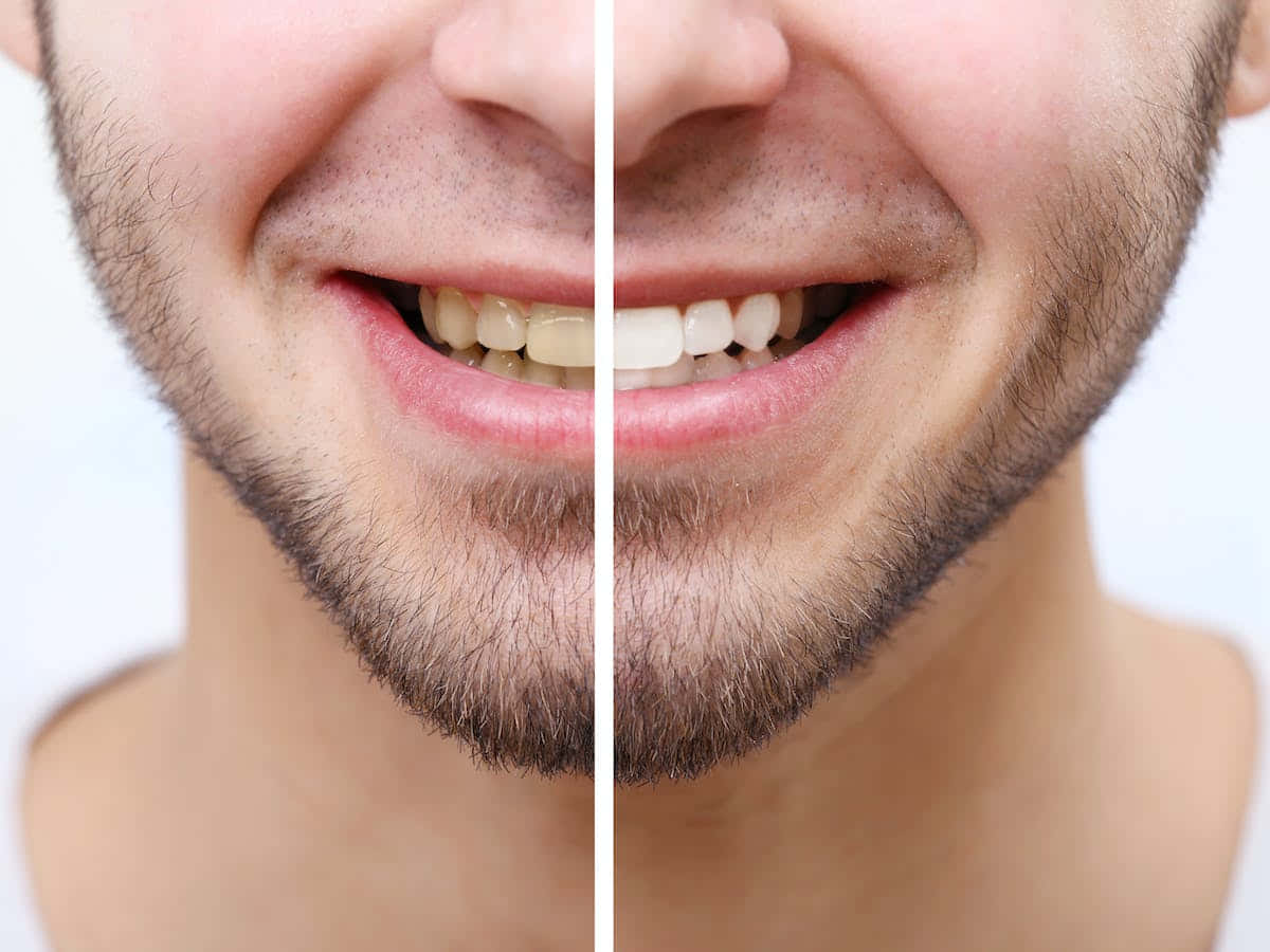 teeth whitening, yellow teeth, bright white teeth, SD Desktop Wallpaper