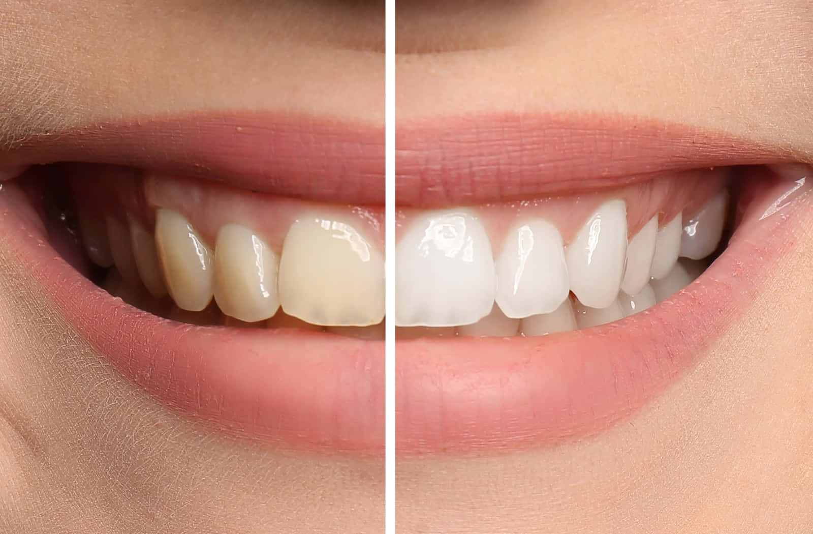 teeth whitening, bright white teeth, yellowed teeth, HD Desktop Wallpaper