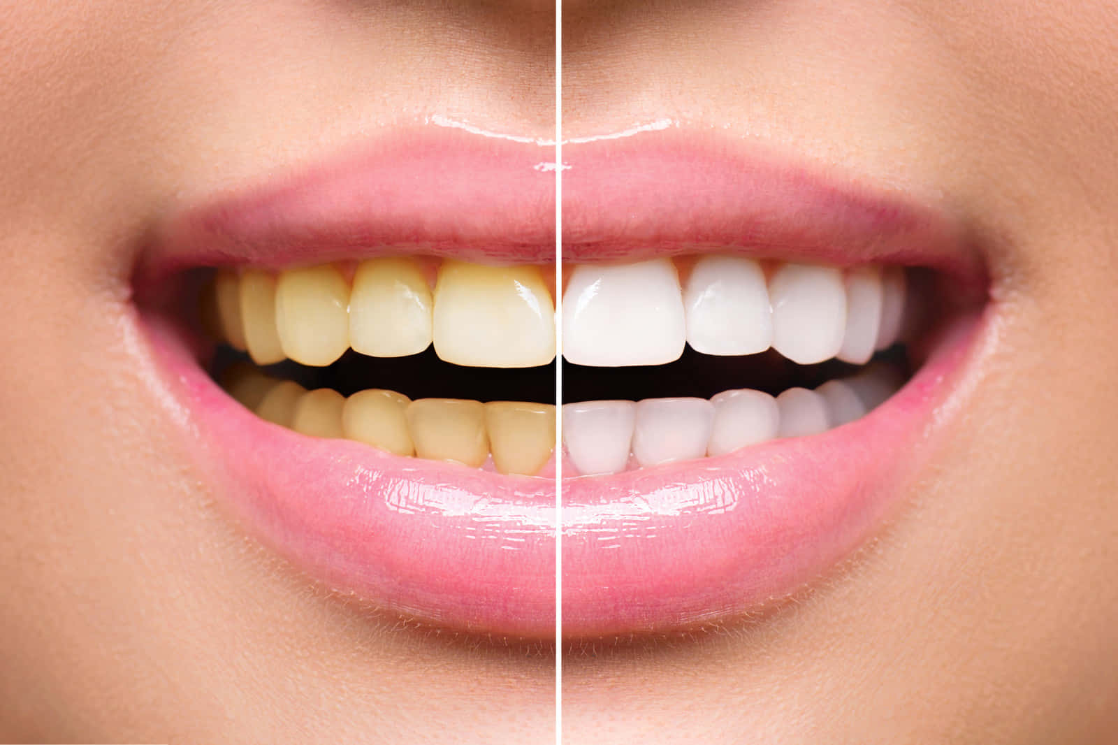 teeth whitening, yellow teeth, bright white teeth, HD Desktop Wallpaper