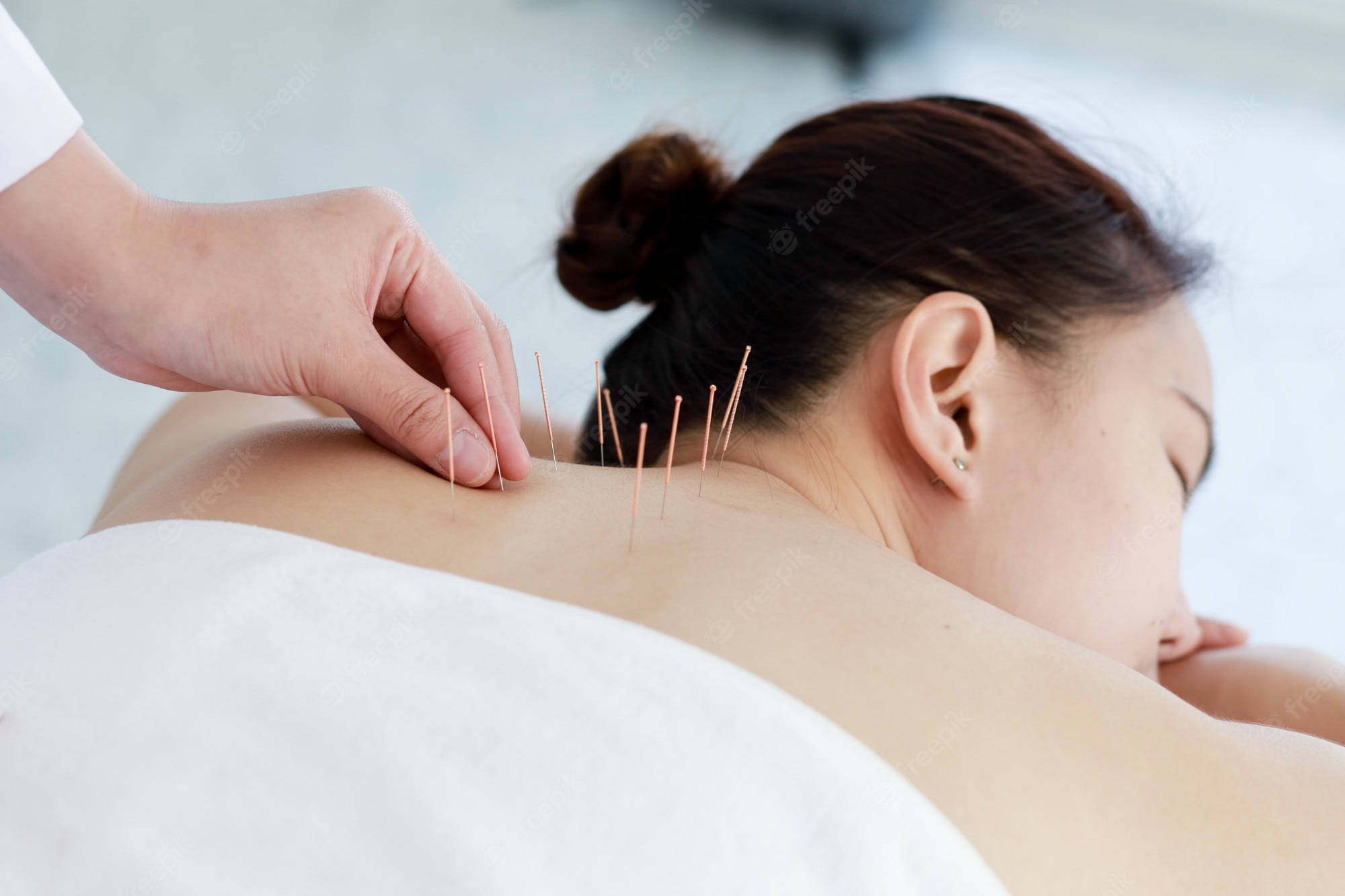 acupuncturist, neck therapy, acupuncture treatment, Full HD Desktop Wallpaper