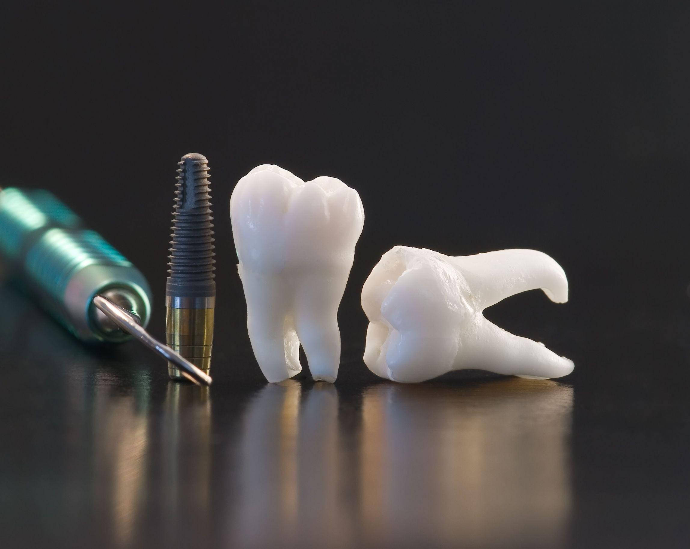 dental tools, tooth implant, extracted tooth, Full HD Desktop Wallpaper