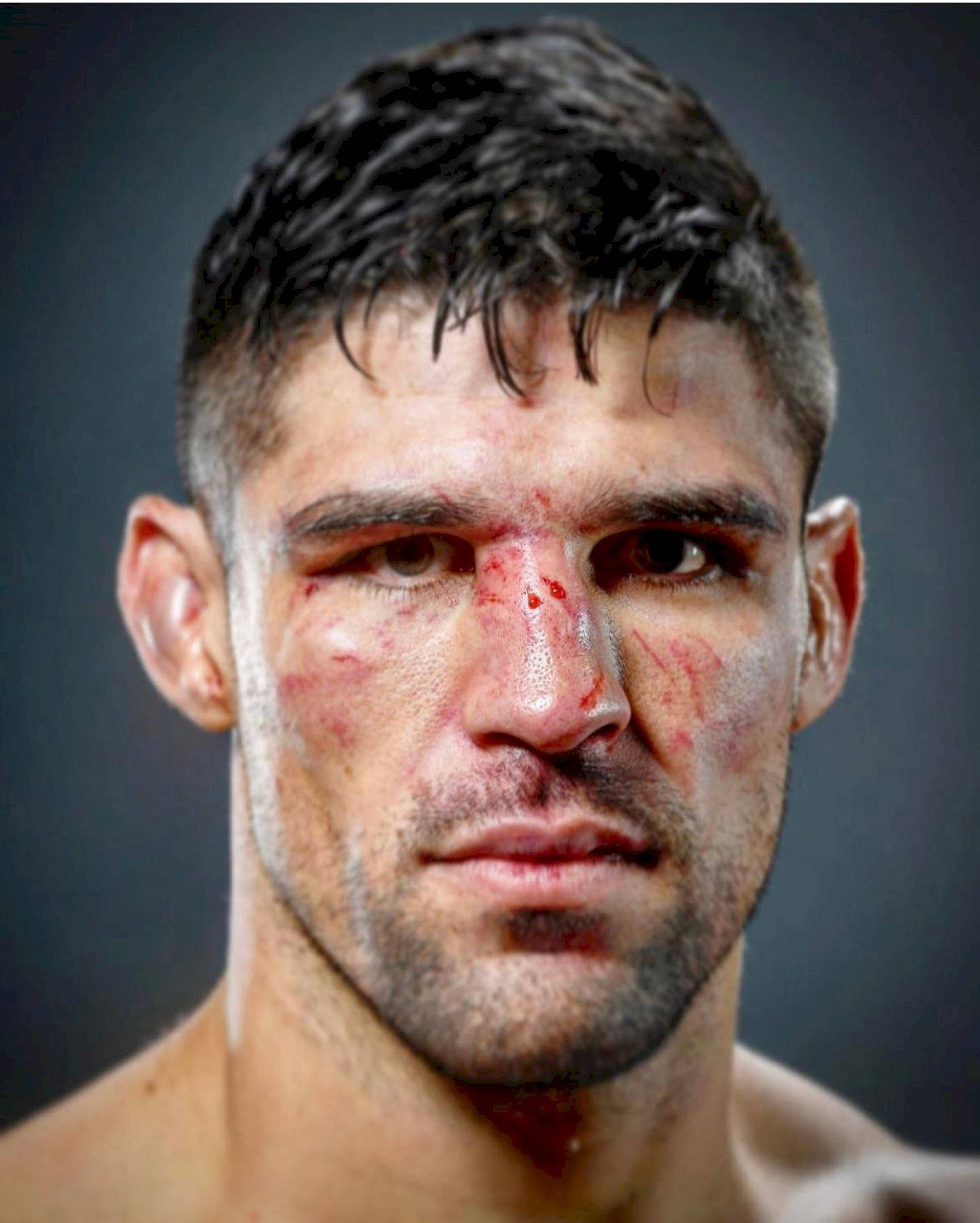 Vicente Luque, face injuries, bruised, Full HD Phone Wallpaper