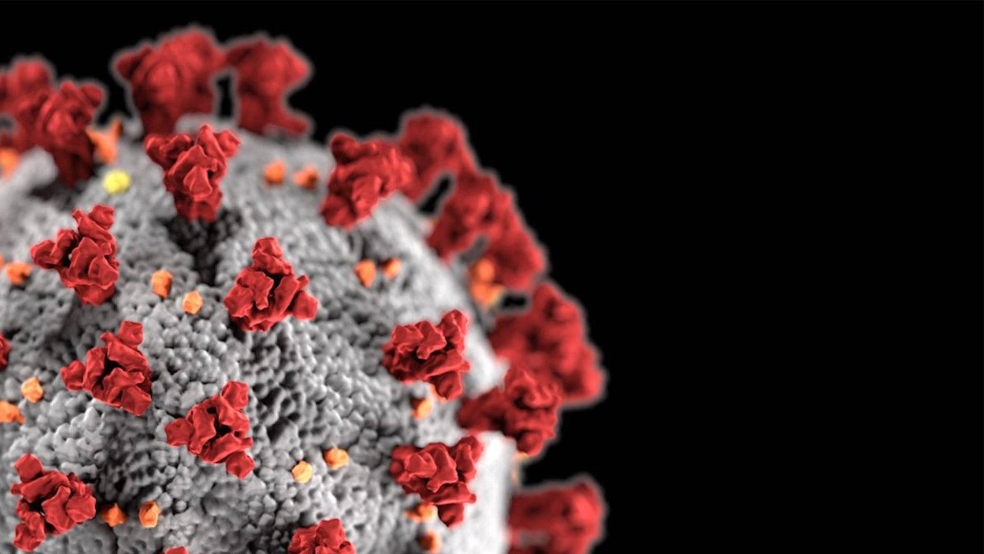 coronavirus, red spike proteins, black background, Full HD Desktop Wallpaper