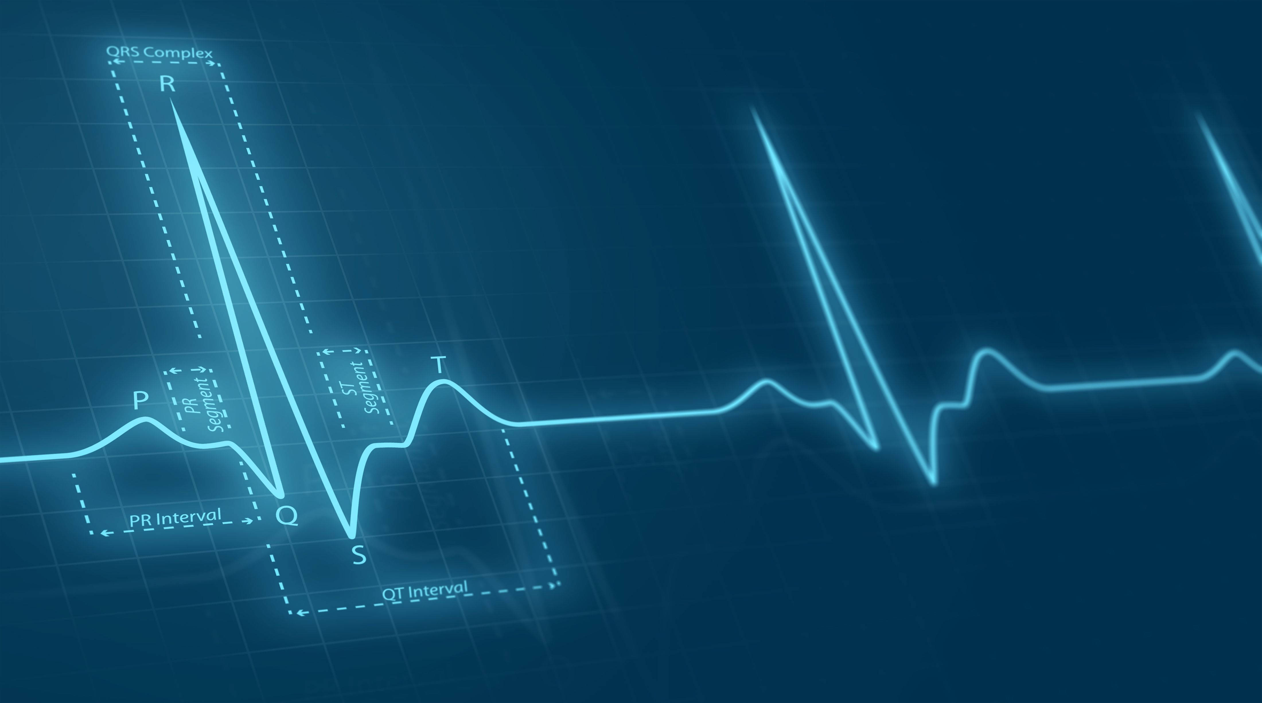 glowing blue electrocardiogram waveform, labeled peaks and intervals, dark grid background, 4K Desktop Wallpaper
