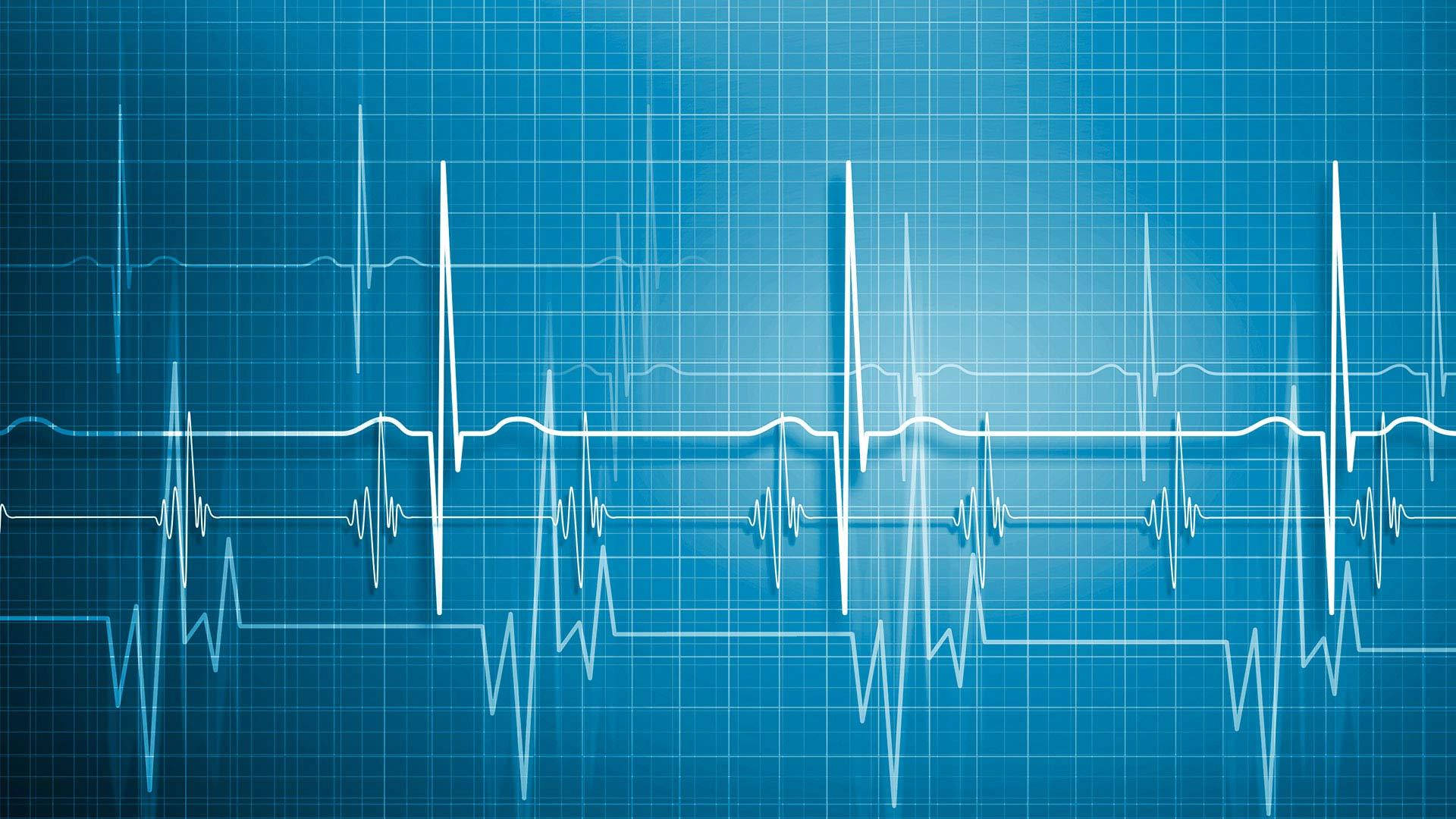 electrocardiogram lines, blue grid background, pulse rhythmically, Full HD Desktop Wallpaper
