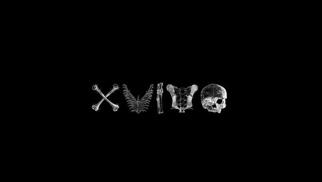 X-Ray