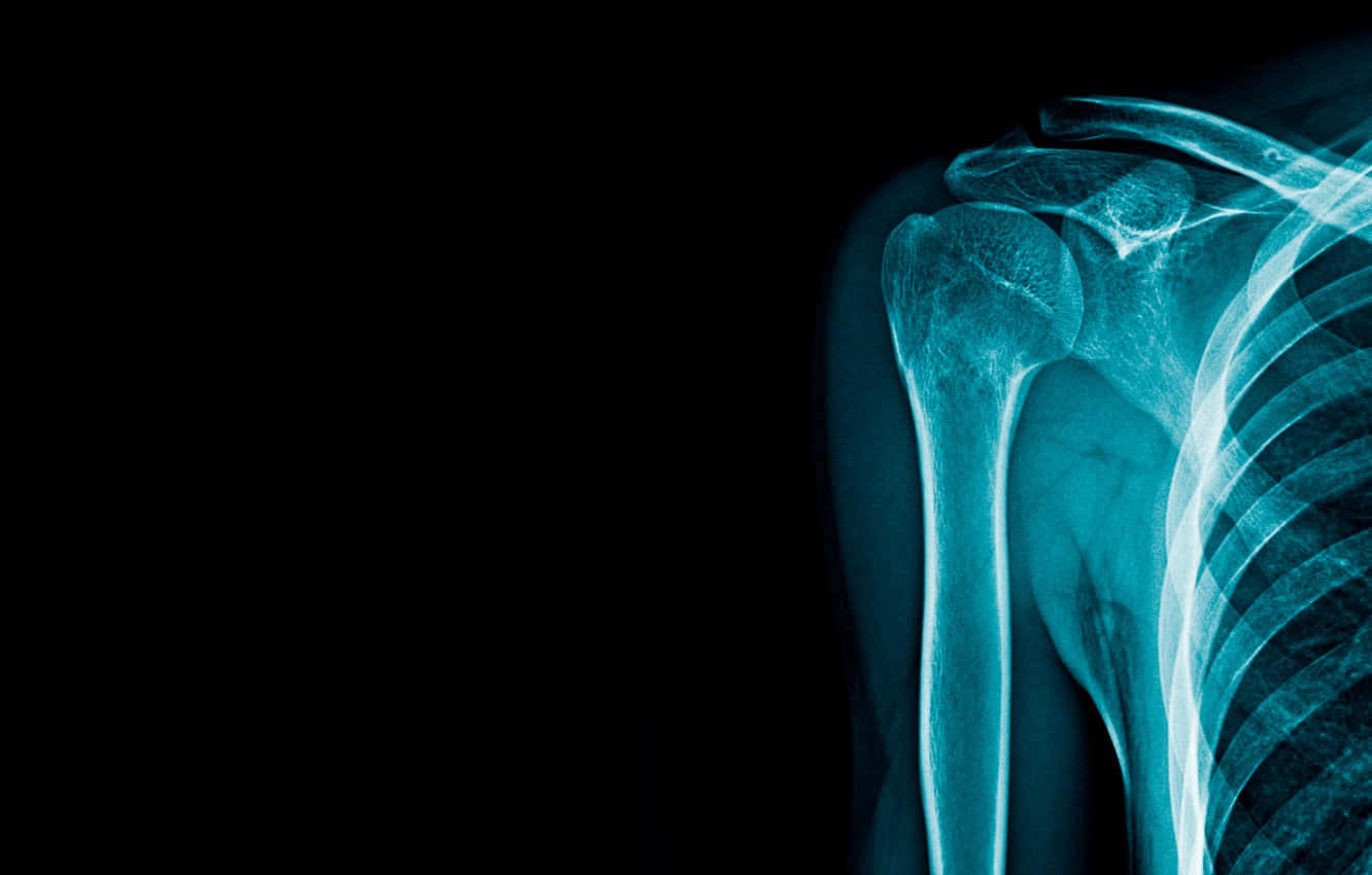 x ray, glowing blue, human shoulder joint, HD Desktop Wallpaper