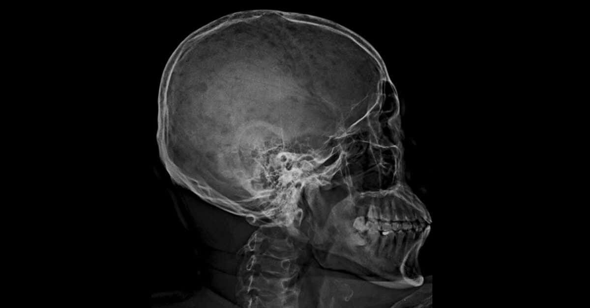 X Ray, human skull, upper spine, SD Desktop Wallpaper