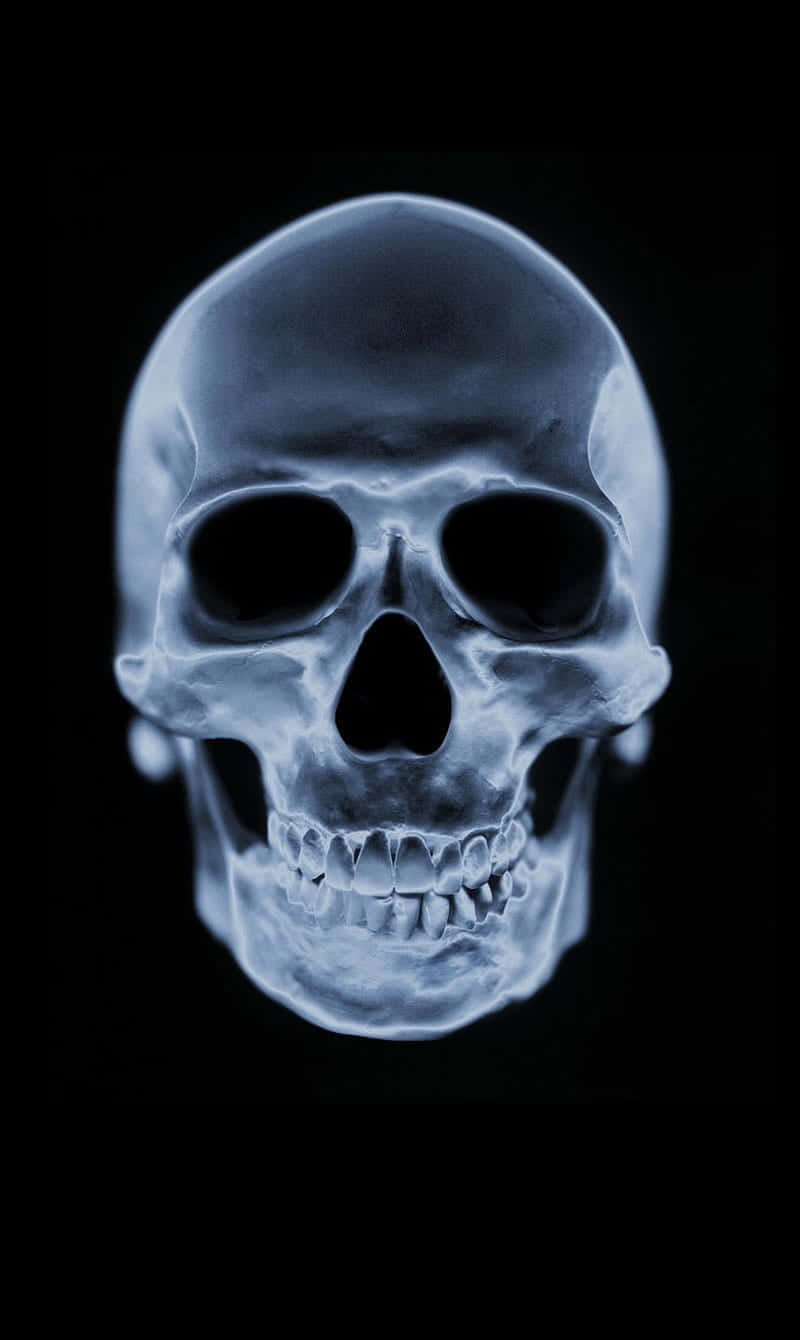 X Ray, glowing x-ray style, human skull, HD Phone Wallpaper