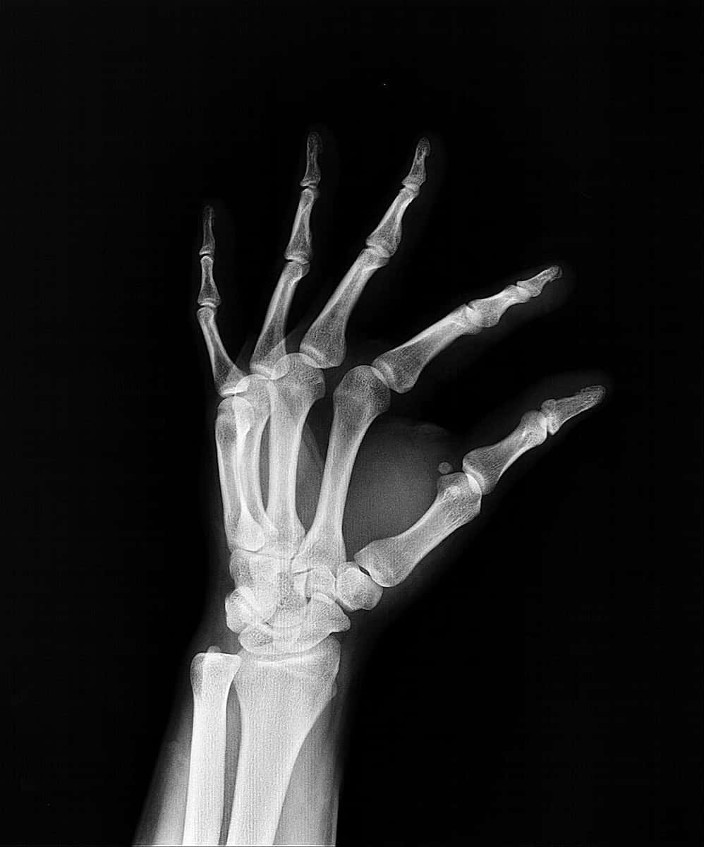 x ray, human hand, bone structure, SD Phone Wallpaper