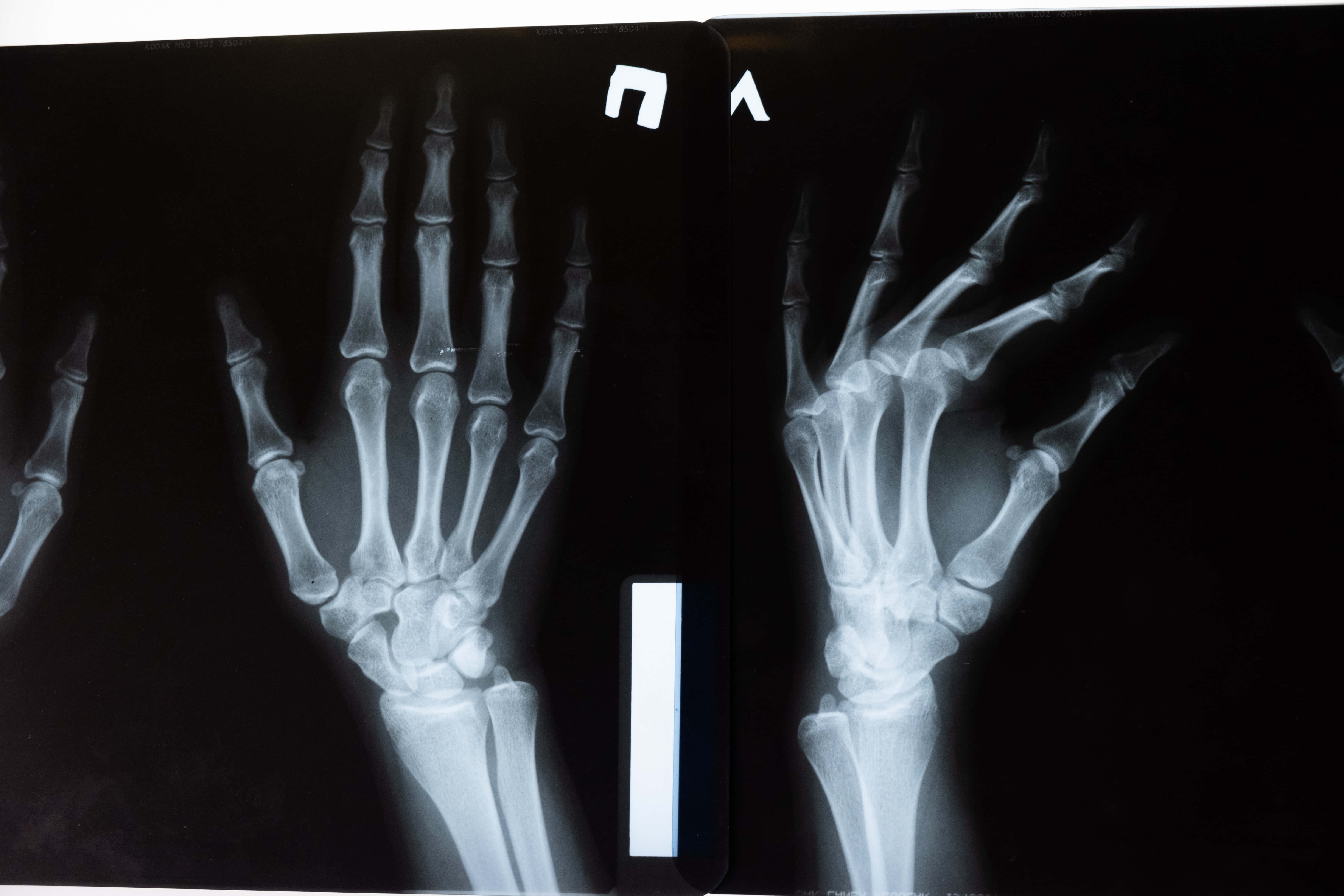 X Ray, hands, human hands, 5K Desktop Wallpaper