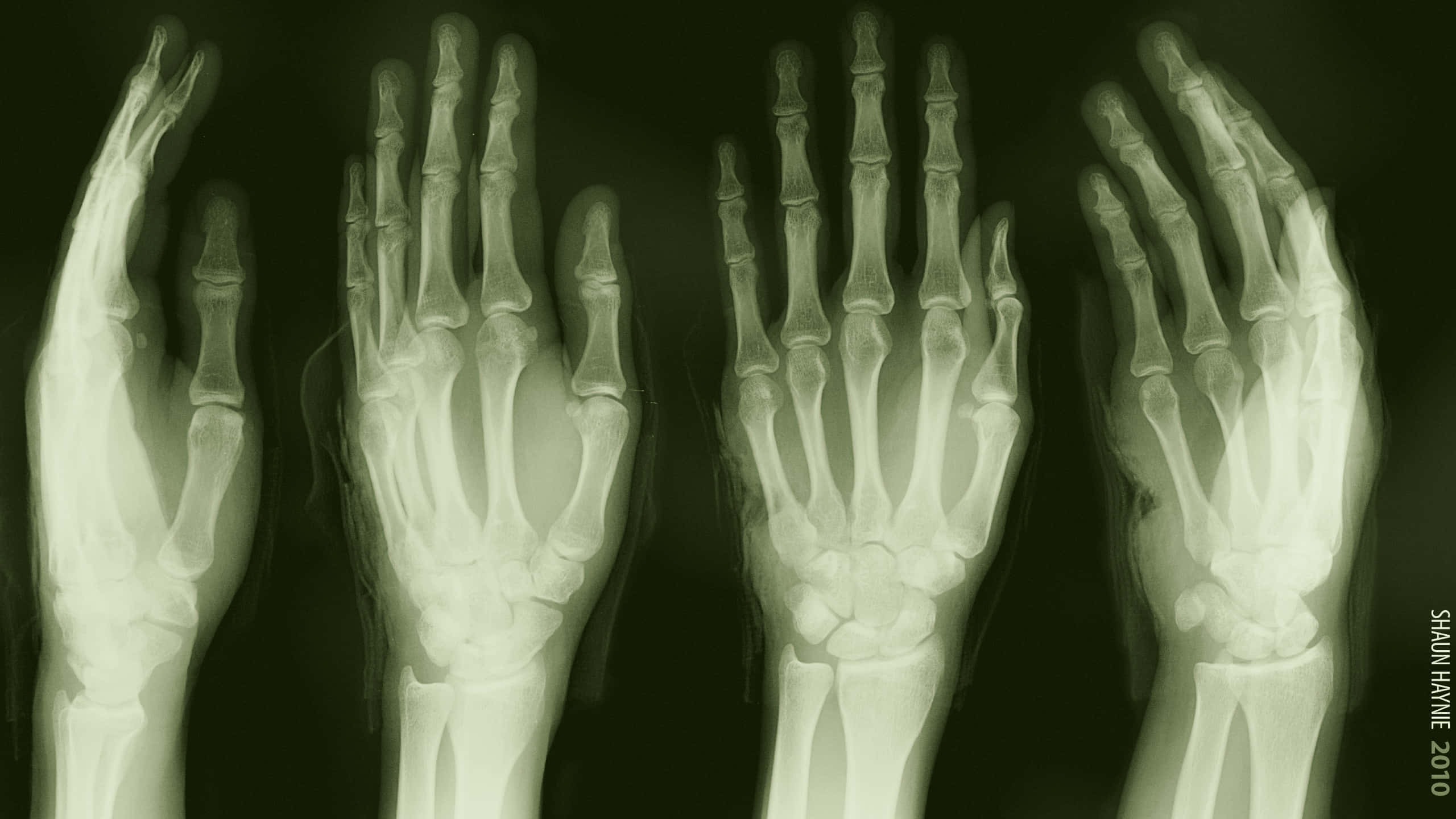 x ray, hands, eerie green, 2K Desktop Wallpaper