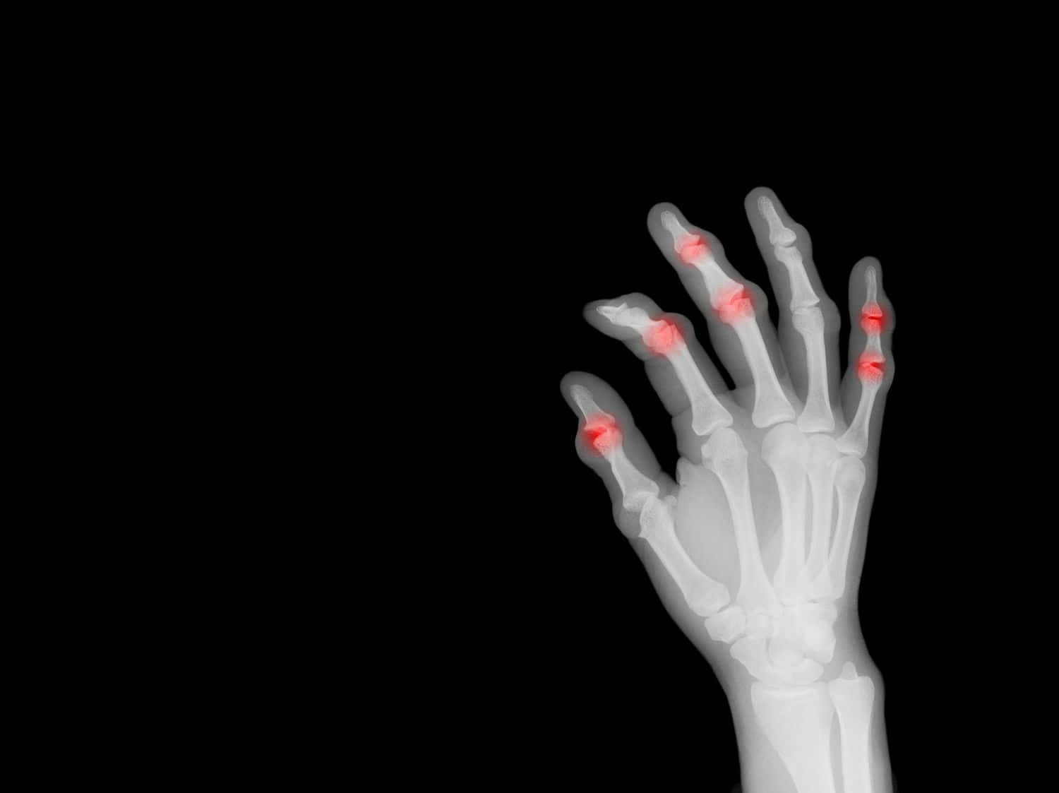 X Ray, hand, finger, HD Desktop Wallpaper