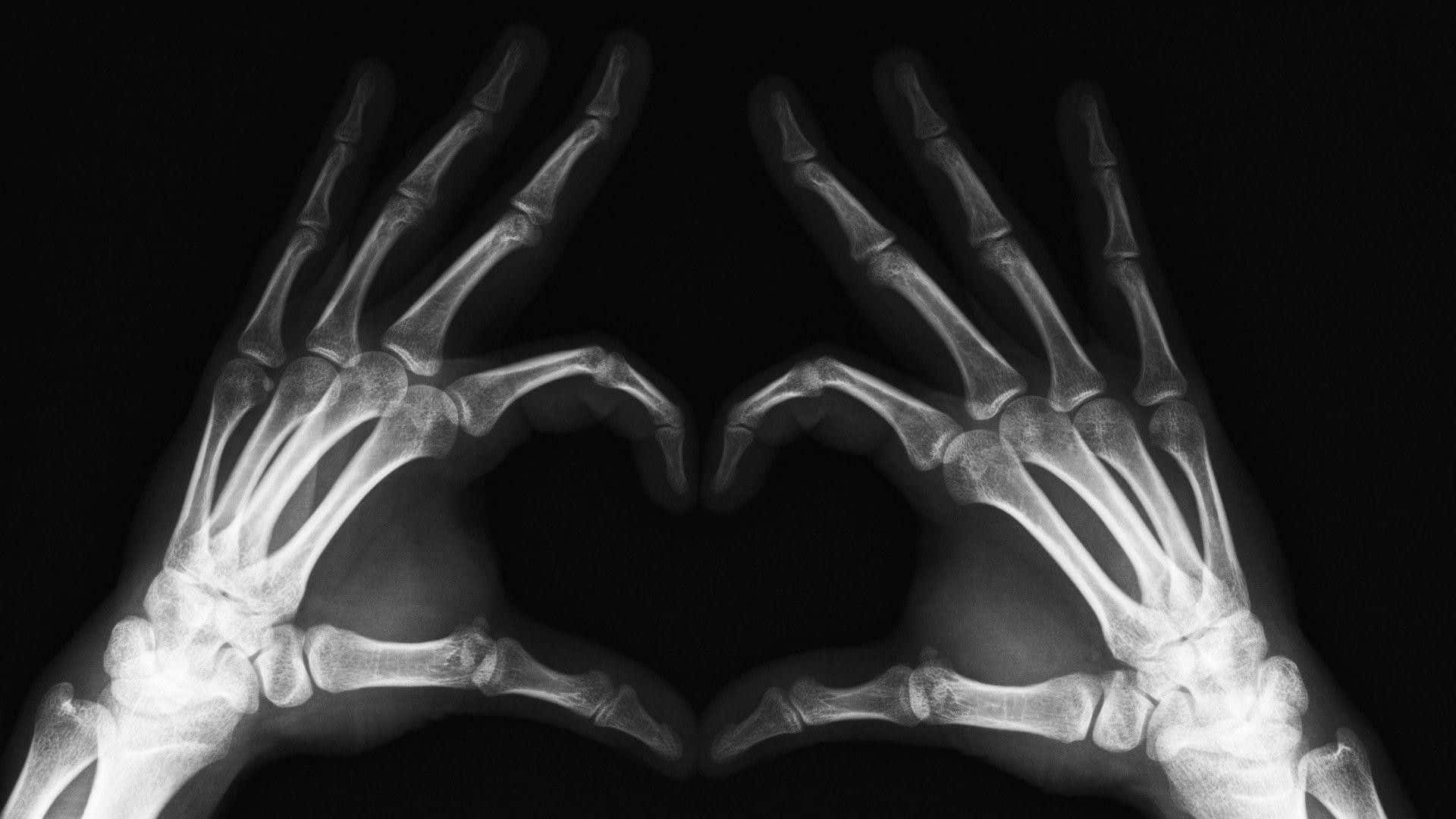 X Ray, hands, heart shape, Full HD Desktop Wallpaper
