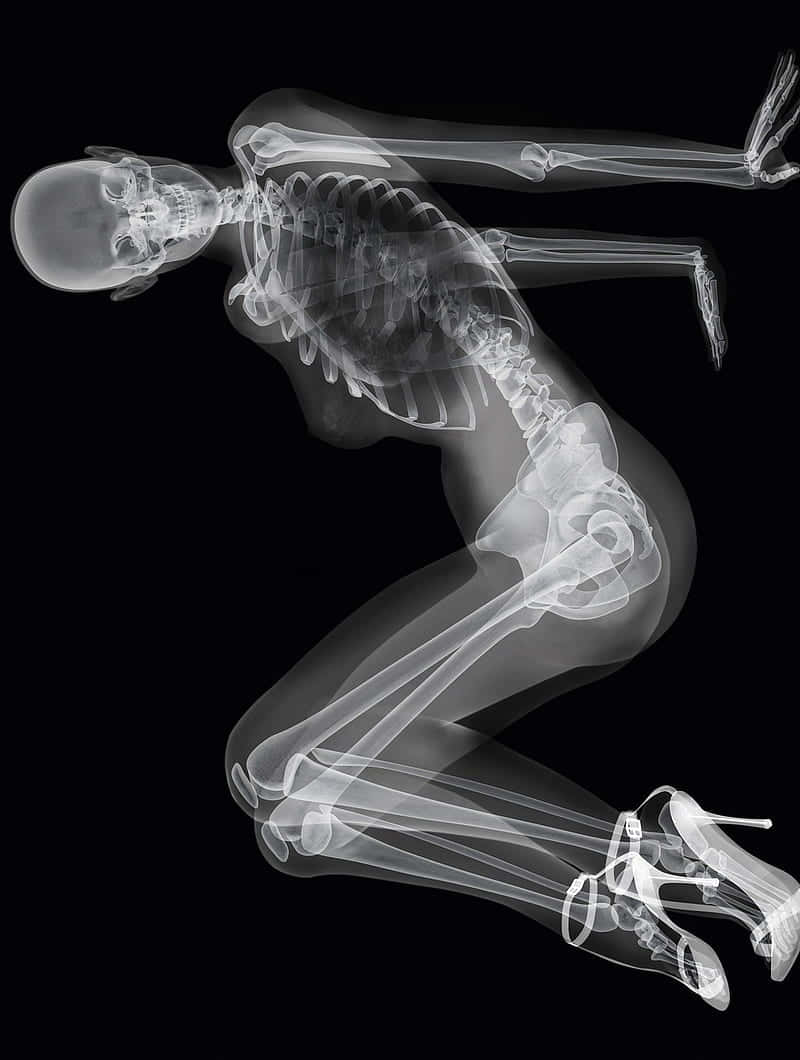 X Ray, human skeleton, dynamic kneeling pose, SD Phone Wallpaper